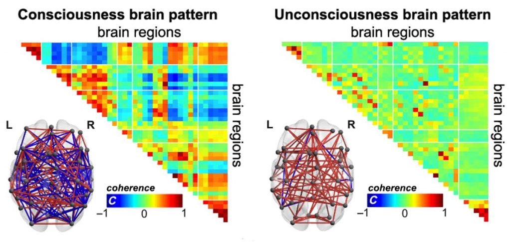 In consciousness and unconsciousness, our brains have different modes to self-organize as time goes by. When we are conscious, brain regions communicate with a rich temperament, showing both positive and negative connections. Image Credit: E. Tagliazucchi & A. Demertzi.