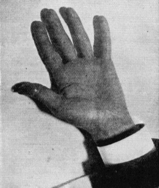 The hand of Nikola Tesla captured by his artificial daylight.