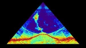 A sonar image. Image Credit: MAYOBS - CNRS/IPGP/IFREMER/BRGM.