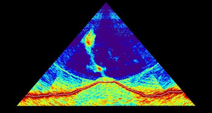 A sonar image. Image Credit: MAYOBS - CNRS/IPGP/IFREMER/BRGM.