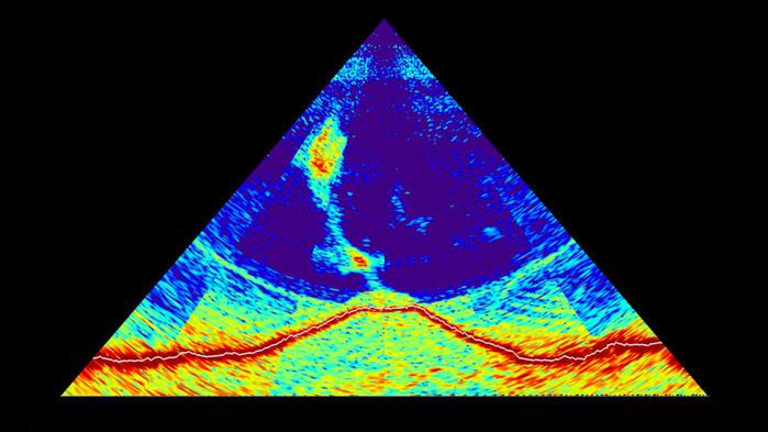 A sonar image. Image Credit: MAYOBS - CNRS/IPGP/IFREMER/BRGM.
