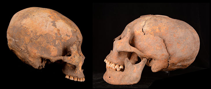 Artificial cranial deformation at the archaeological site of Houtaomuga. Image Credit: Science News.
