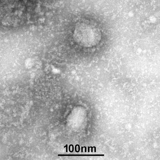 Transmission electron micrograph of two 2019-nCoV virions. Image Credit: Wikimedia Commons.