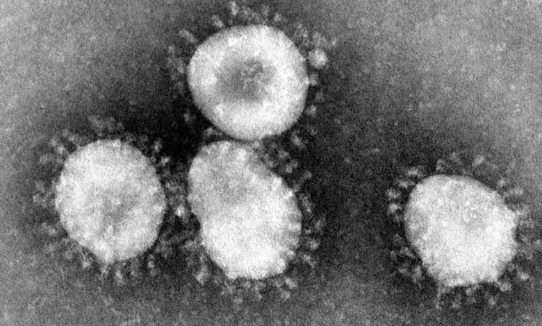 Electron micrograph of coronaviruses. Image Credit: Wikimedia Commons.