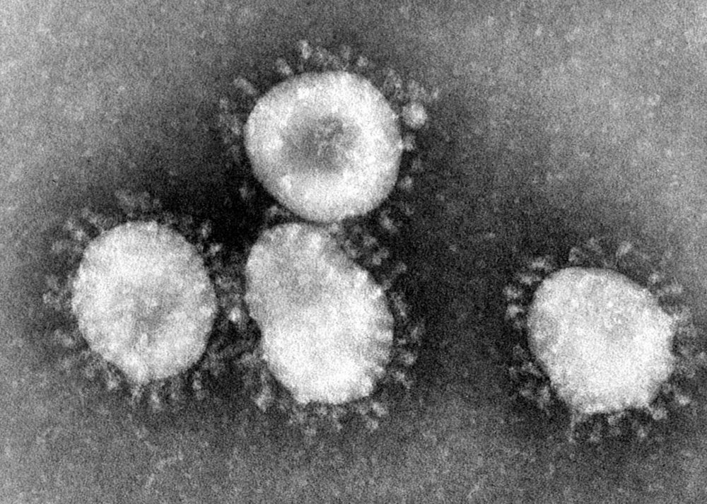 Electron micrograph of coronaviruses. Image Credit: Wikimedia Commons.