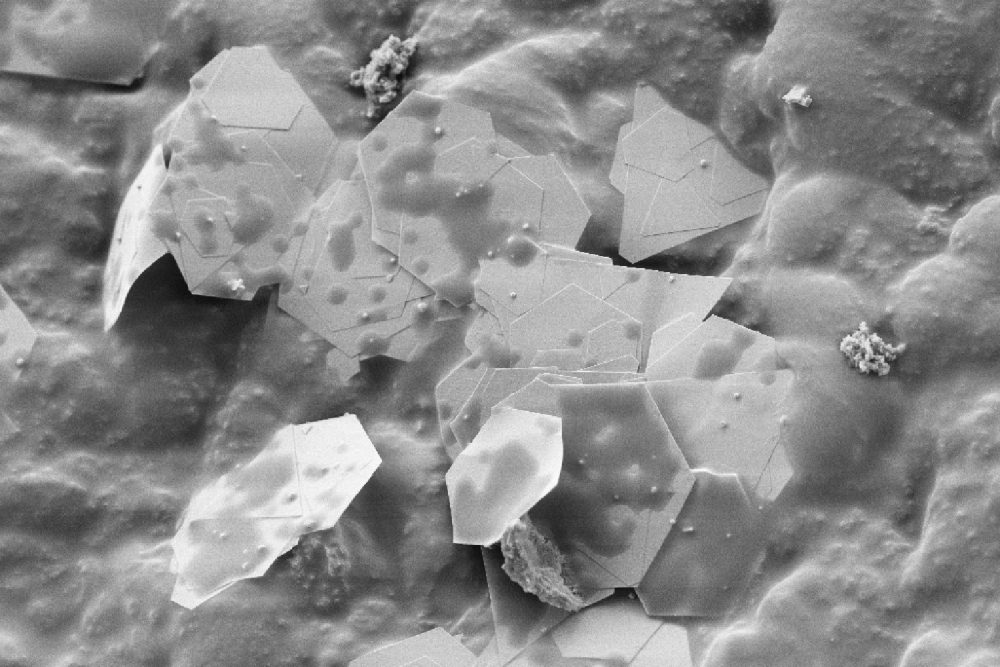 Gold nanoplatelets embedded in a latex matrix. Image Credit: Stephan Handschin/ScopeM/ETH Zurich.