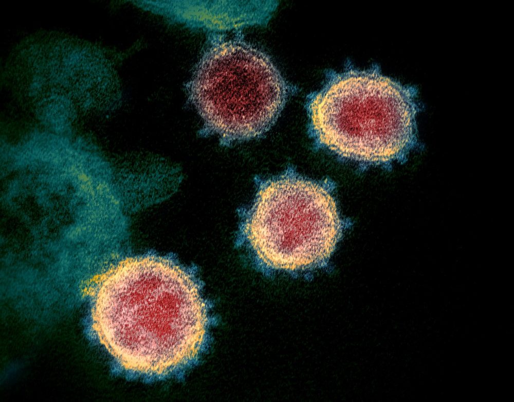 A microscopic image of the Coronavirus SARS-CoV-2. Image Credit: Wikimedia Comons.