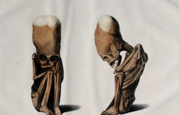 Lithograph of a fetus