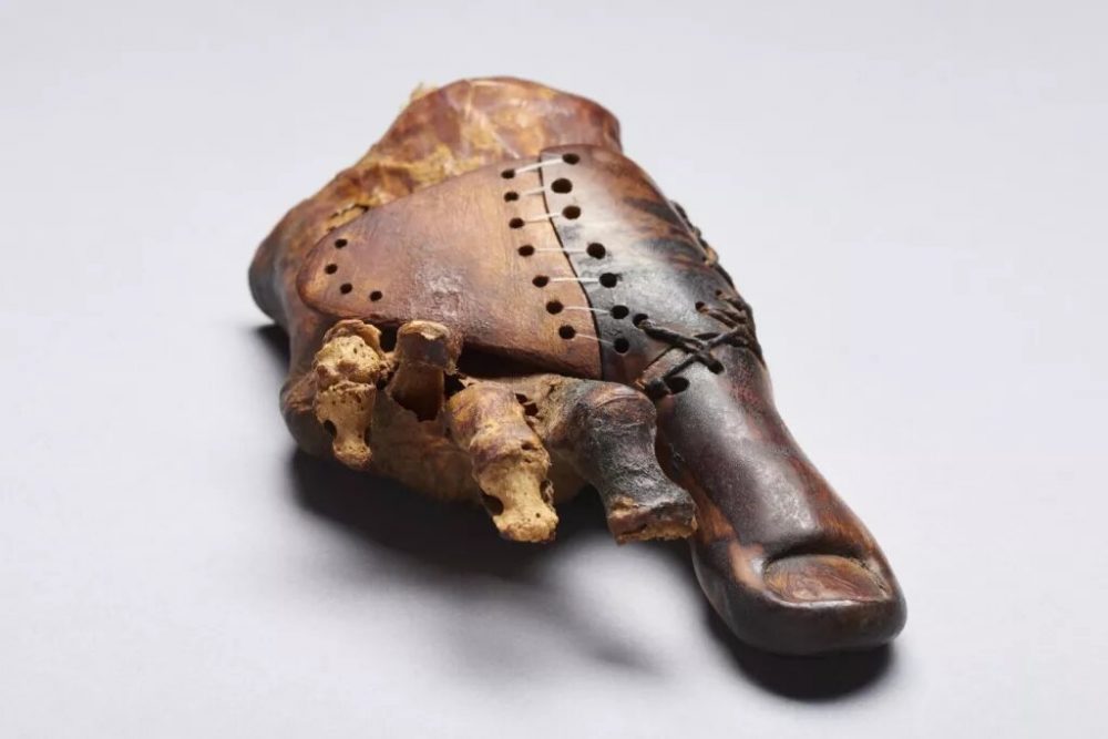 A 3,000-year-old wooden toe prosthetic discovered several years ago on a mummy. Ancient Egyptian medicine was truly advanced for its time. Credit: Matjaž Kačičnik/University of Basel, LHTT