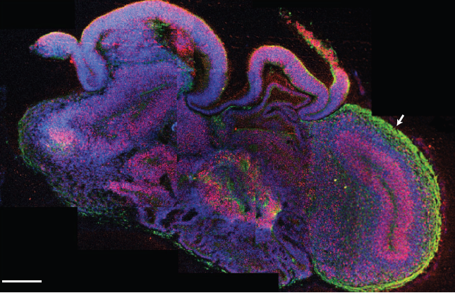 A section of a brain organoid with different sections, stained by immunohistochemistry for markers of neurons (green) and progenitor cells (red). Credit: Madeline A. Lancaster et al / Nature 2013
