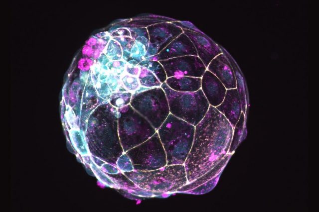 Scientists created an artificial human embryo. Credit: Alok Javali, Heidar Heidari and Theresa Sommer/Institute of Molecular Biology of the Austrian Academy of Sciences via AP
