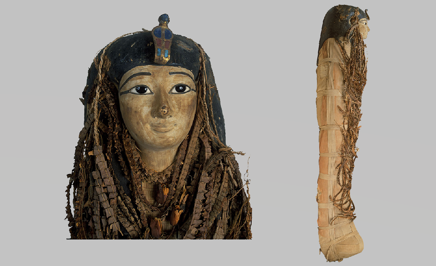 Picture of the ancient Egyptian mummy of Amenhotep I. Credit: Sahar Saleem and Zahi Hawass / Frontiers in Medicine, 2021
