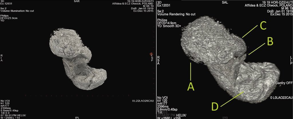 Interpretation of the CT data of the fetus. Credit: Ejsmond et al., J. Archaeol. Sci., 2022