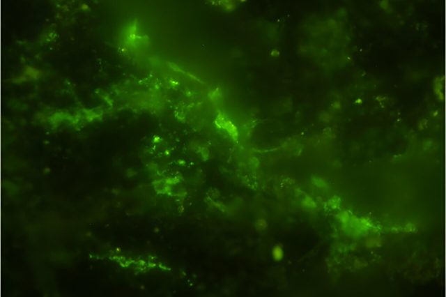 A group of microbial cells, highlighted in green, is shown in the image, where their DNA is visibly present inside each cell. Initially, these microbes were discovered in tiny fractures within the rock sample using an advanced infrared technique called O-PTIR spectroscopy. Following this, the cells were treated with a green dye and further analyzed under both a scanning electron microscope and fluorescent microscopy. By combining data from these three imaging methods, researchers were able to confirm that the microbes were both native to the 2-billion-year-old rock and still living. Credit: Y. Suzuki, S. J. Webb, M. Kouduka et al. 2024/ Microbial Ecology/ CC BY NC ND