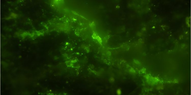 A group of microbial cells, highlighted in green, is shown in the image, where their DNA is visibly present inside each cell. Initially, these microbes were discovered in tiny fractures within the rock sample using an advanced infrared technique called O-PTIR spectroscopy. Following this, the cells were treated with a green dye and further analyzed under both a scanning electron microscope and fluorescent microscopy. By combining data from these three imaging methods, researchers were able to confirm that the microbes were both native to the 2-billion-year-old rock and still living. Credit: Y. Suzuki, S. J. Webb, M. Kouduka et al. 2024/ Microbial Ecology/ CC BY NC ND