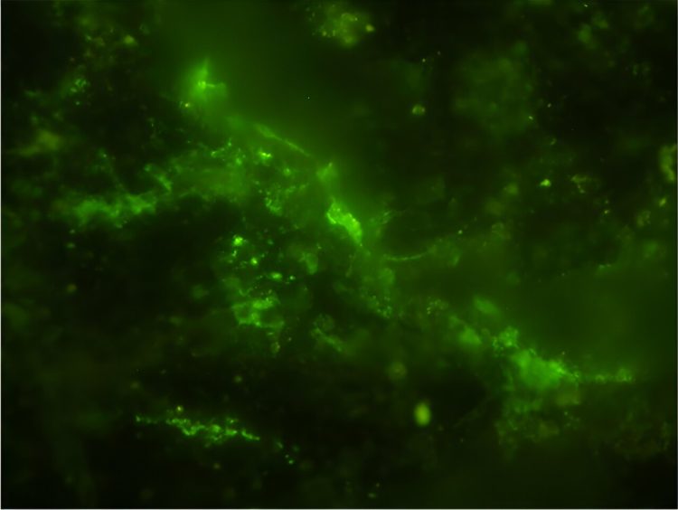 A group of microbial cells, highlighted in green, is shown in the image, where their DNA is visibly present inside each cell. Initially, these microbes were discovered in tiny fractures within the rock sample using an advanced infrared technique called O-PTIR spectroscopy. Following this, the cells were treated with a green dye and further analyzed under both a scanning electron microscope and fluorescent microscopy. By combining data from these three imaging methods, researchers were able to confirm that the microbes were both native to the 2-billion-year-old rock and still living. Credit: Y. Suzuki, S. J. Webb, M. Kouduka et al. 2024/ Microbial Ecology/ CC BY NC ND