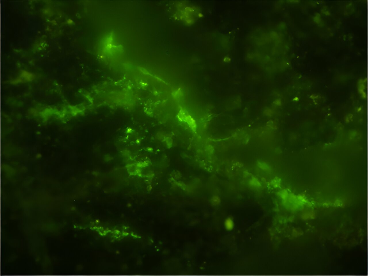 A group of microbial cells, highlighted in green, is shown in the image, where their DNA is visibly present inside each cell. Initially, these microbes were discovered in tiny fractures within the rock sample using an advanced infrared technique called O-PTIR spectroscopy. Following this, the cells were treated with a green dye and further analyzed under both a scanning electron microscope and fluorescent microscopy. By combining data from these three imaging methods, researchers were able to confirm that the microbes were both native to the 2-billion-year-old rock and still living. Credit: Y. Suzuki, S. J. Webb, M. Kouduka et al. 2024/ Microbial Ecology/ CC BY NC ND